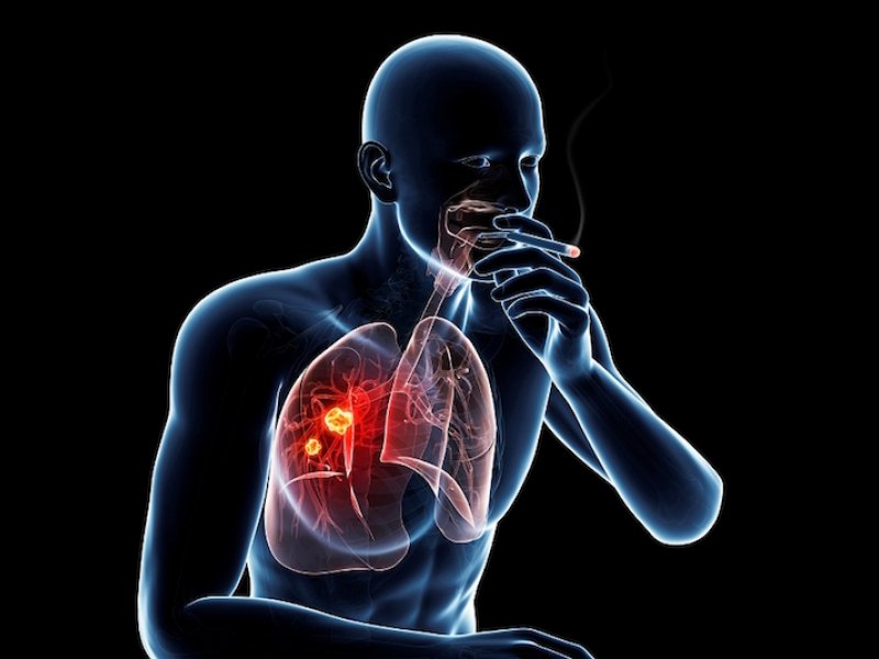 Κορoνοϊός: Κάπνισμα, τι συμβαίνει στους πνεύμονες και πολλά άλλα