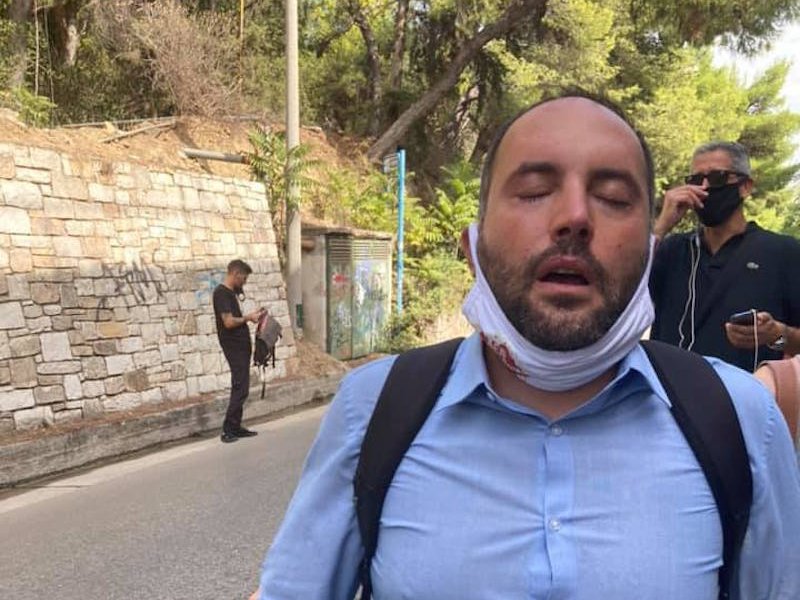 Απρόκλητη επίθεση δηλώνει ο βουλευτής του Σύριζα Ευβοίας, Μίλτος Χατζηγιαννάκης