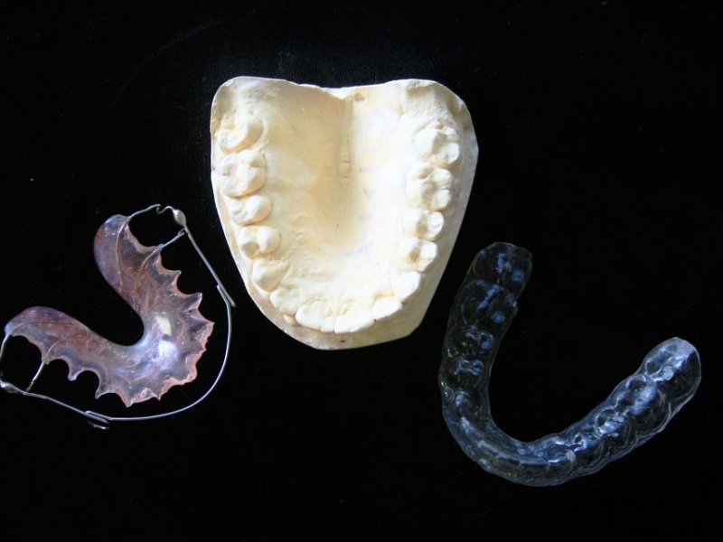 Οι ασθενείς Covid-19 με μασέλα έχουν περισσότερα επικίνδυνα μικρόβια στο στόμα τους