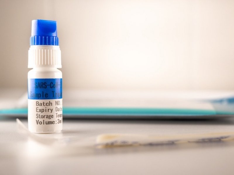 Νέο test για κορονοϊό και γρίπη με το  smartphone σας !