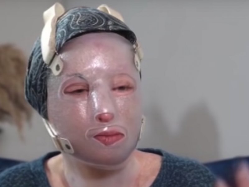 Αννίτα Ναθαναήλ για Ιωάννα Παλιοσπύρου: «Το τελευταίο χειρουργείο δεν πήγε καλά» (Βίντεο)