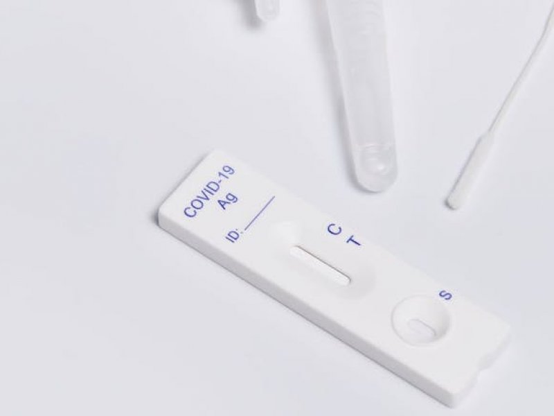 Κορονοϊός: Τι θα γίνει με το rapid test ανεμβολίαστων εργαζόμενων – Μέχρι πότε θα ισχύει το μέτρο